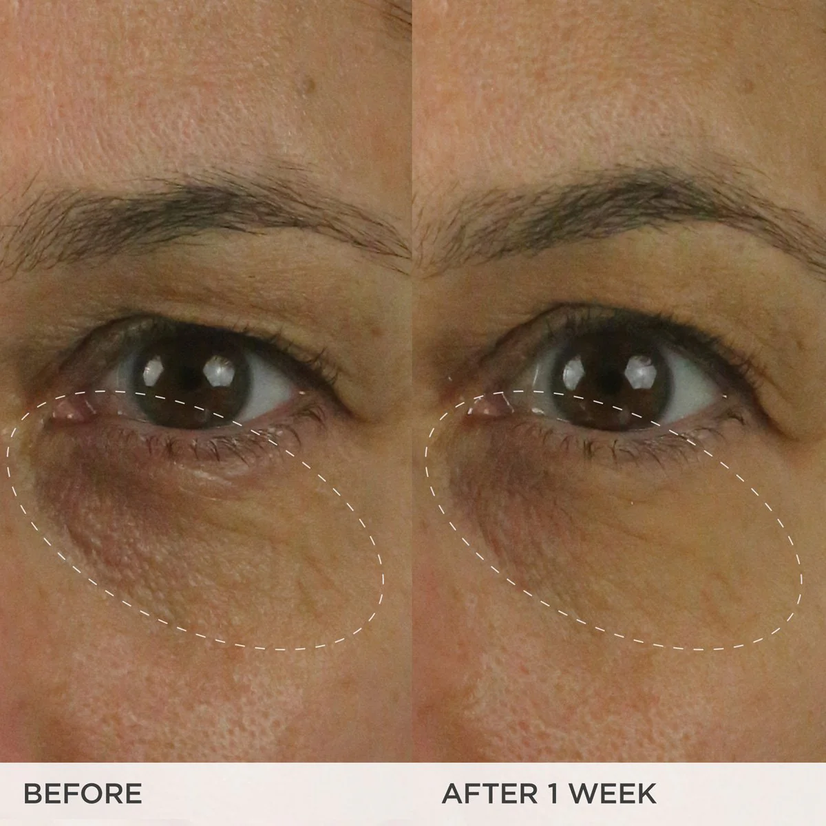 The Brightening Eye Cream - Image 4